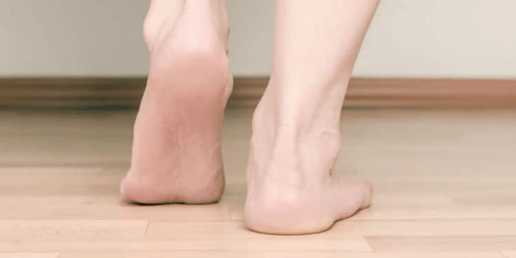 How Flat Feet and Back Pain Are Related